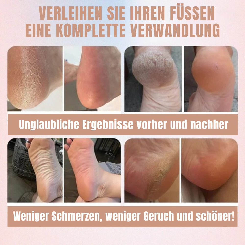 👣 PediPure™ | Für perfekte und weiche Füße in wenigen Minuten